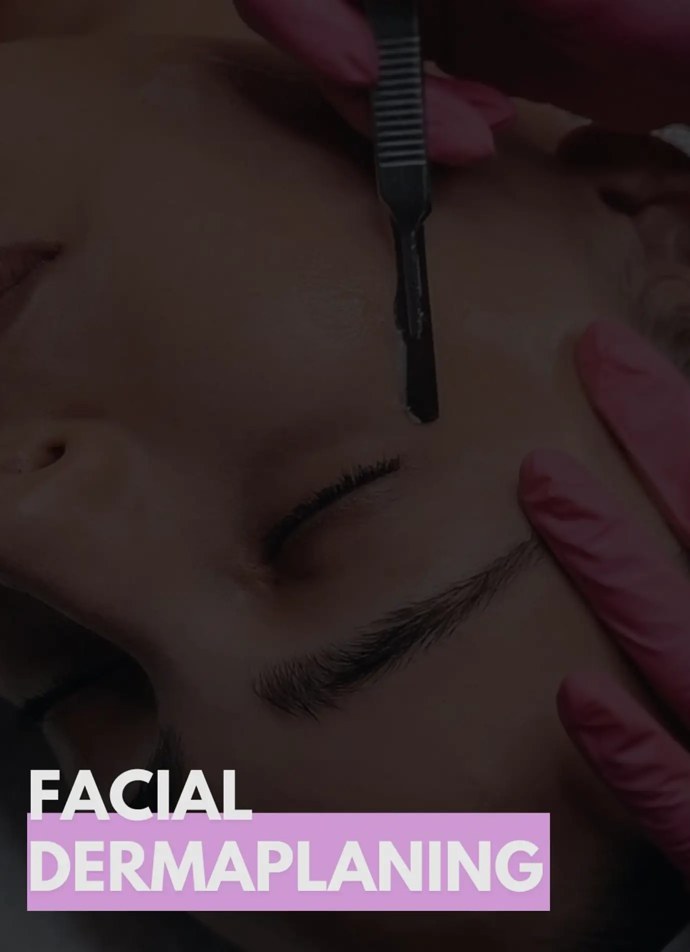 professional dermaplaning Brisbane