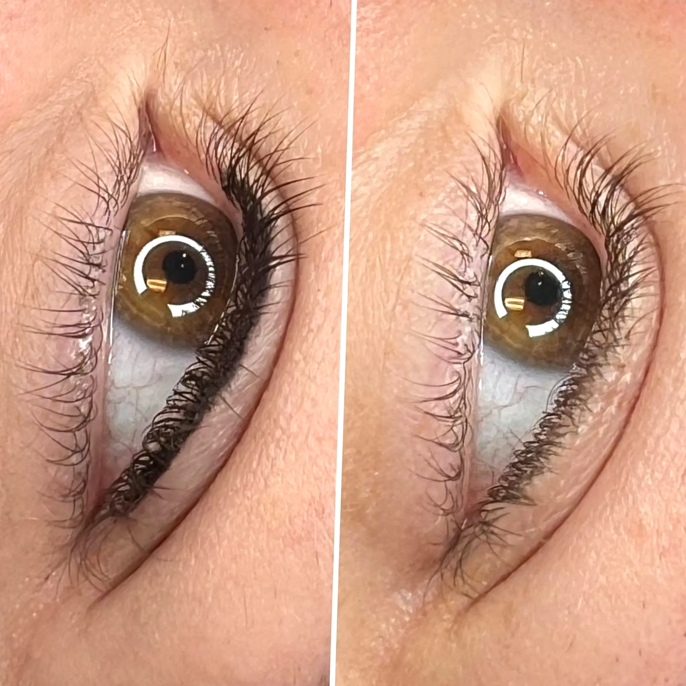 eyeliner tattoo lash loss
